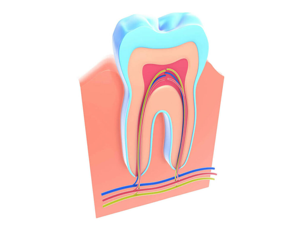 illustration of a root canal treatment